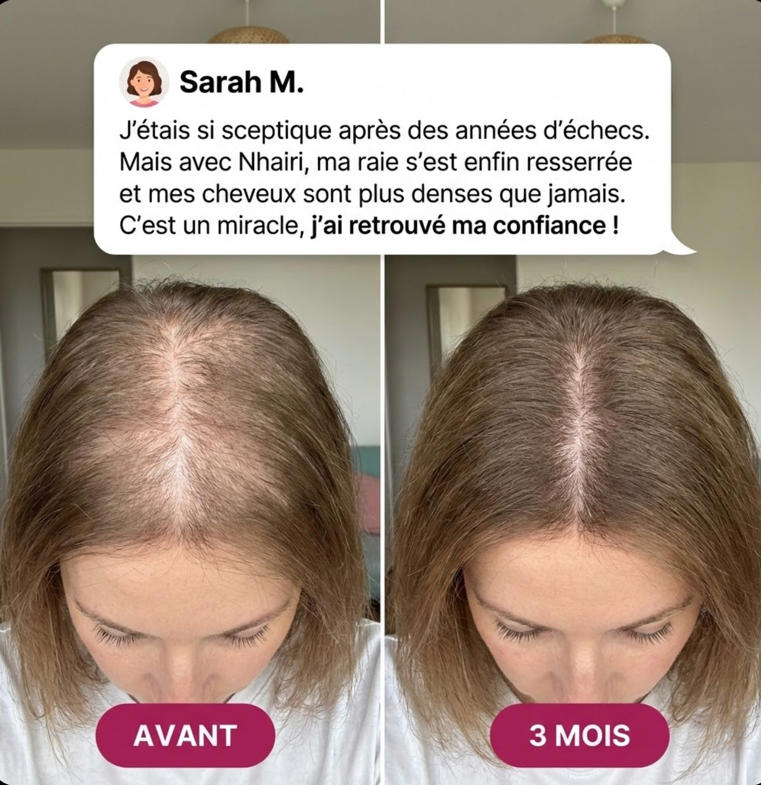 Pousse & Croissance des Cheveux